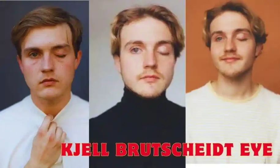 What Happened To Kjell Brutscheidt Eye Injury